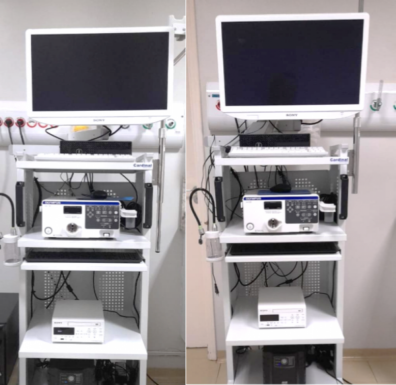 AME Catanduva recebe novos equipamentos de endoscopia, broncoscopia e colonoscopia
